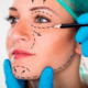 Cirugía facial